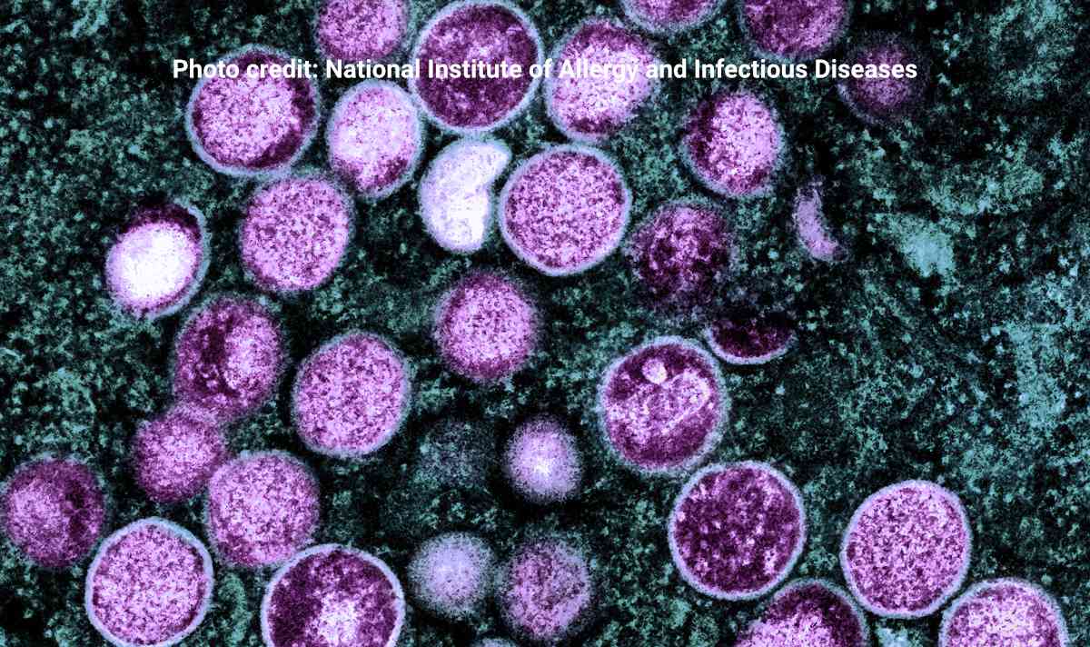 Colorized transmission electron micrograph of monkeypox particles (purple) found within an infected cell (teal), cultured in the laboratory. Image captured and color-enhanced at the NIAID Integrated Research Facility (IRF) in Fort Detrick, Maryland. Credit: National Institute of Allergy and Infectious Diseases.